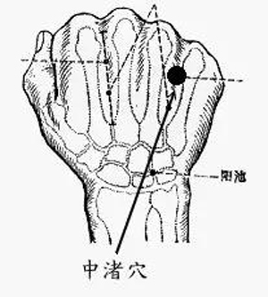 中渚