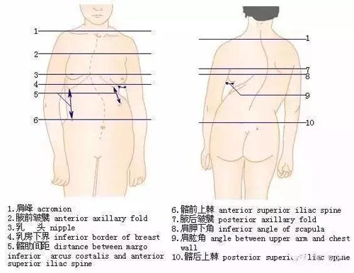 脊柱侧凸躯干两侧的高低变化