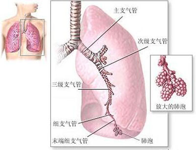 慢性支气管炎