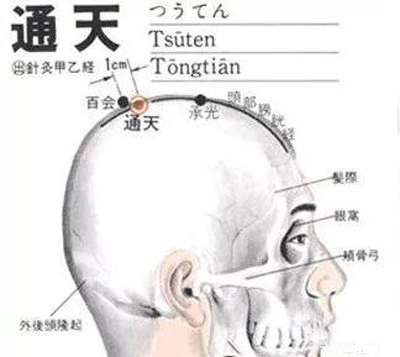 通天穴