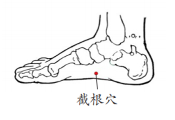 截根穴