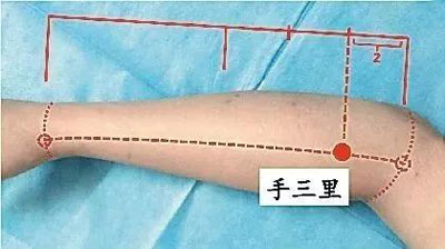 点按十宣穴、后溪穴、手三里，调治手指麻木，见效快！