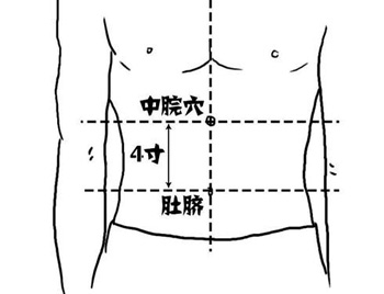 健脾开胃的开关——中脘、痞根