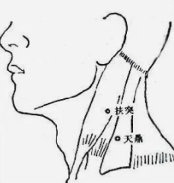 针灸取单穴治愈漏肩风（肩周炎）