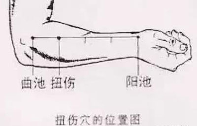 针灸治病的22个奇穴