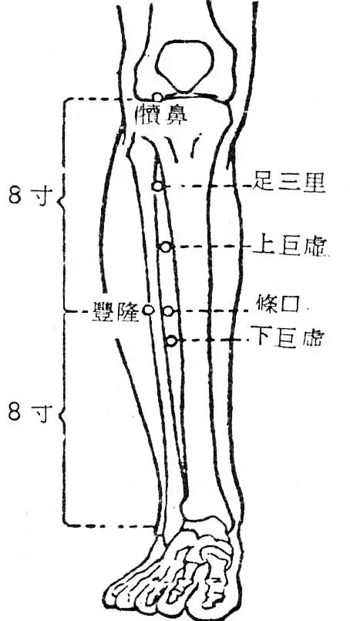 一穴治疗静脉曲张