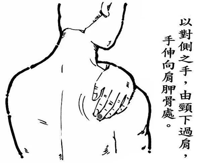 一奇穴治疗乳腺增生