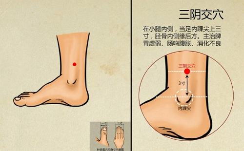 高压高，三阴交放血拔罐