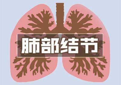 治疗结节好方