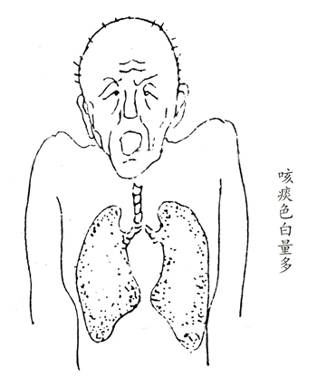 经常吐白痰的，用一味中药即可消痰！