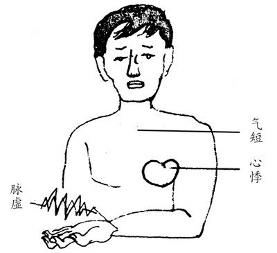 专治心慌、心悸的一款中成药