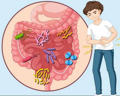 慢性腹泻辨治六法