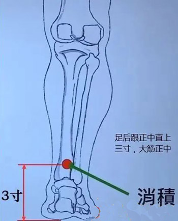 倪海厦：判断肿瘤的奇穴——消积穴