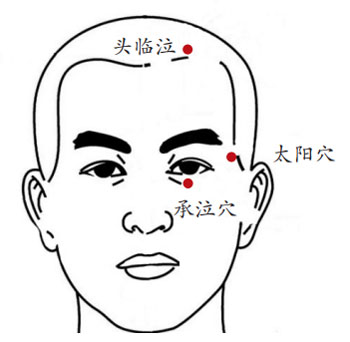 调理迎风流泪的穴位