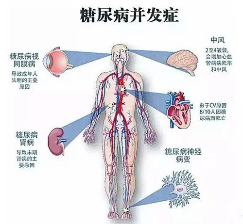 现代医学对高血糖的危害的认识